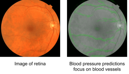 網膜画像から心血管疾患のリスクまで予測す