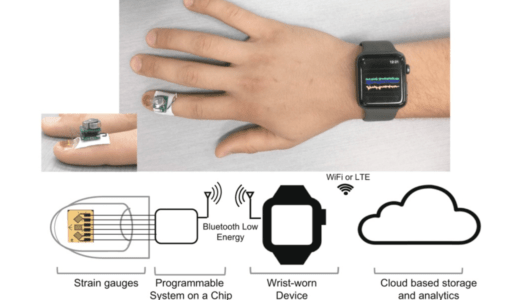 ネイル型センサー×AI。爪先から患者の健