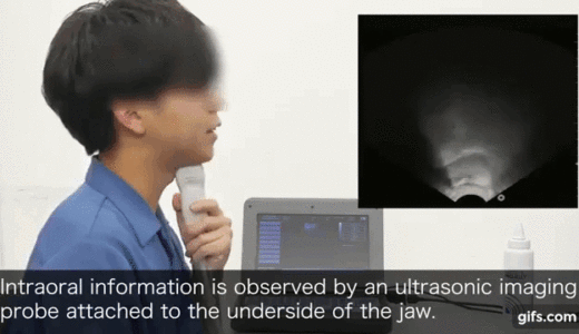 超音波エコー映像とディープラーニングを用