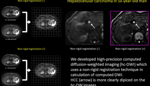 グラフ学習（Graph Transfer